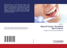 Capa do livro de Beyond Caries: The White Spot Enigma 