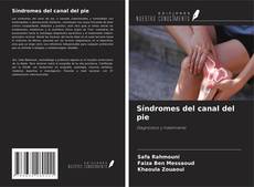 Bookcover of Síndromes del canal del pie