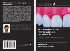 Обложка El tratamiento con microagujas en periodoncia