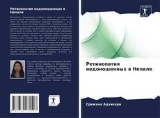 Ретинопатия недоношенных в Непале的封面