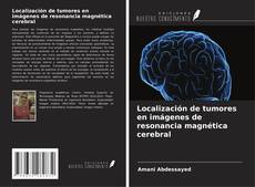 Обложка Localización de tumores en imágenes de resonancia magnética cerebral