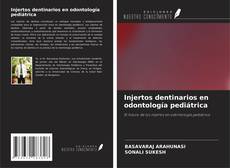 Bookcover of Injertos dentinarios en odontología pediátrica