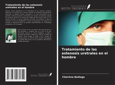 Capa do livro de Tratamiento de las estenosis uretrales en el hombre 