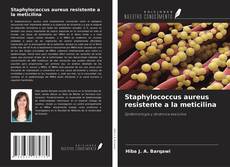 Staphylococcus aureus resistente a la meticilina的封面