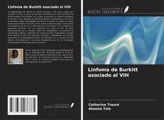 Buchcover von Linfoma de Burkitt asociado al VIH