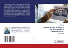 Copertina di Complications In Dental Implant And It’s Management