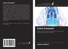 Couverture de Asma bronquial