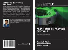 Portada del libro de ALEACIONES EN PRÓTESIS DENTALES