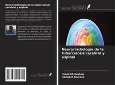 Обложка Neurorradiología de la tuberculosis cerebral y espinal