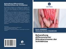 Capa do livro de Behandlung differenzierter Mikrokarzinome der Schilddrüse 