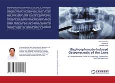 Copertina di Bisphosphonate-Induced Osteonecrosis of the Jaws