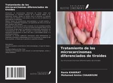 Couverture de Tratamiento de los microcarcinomas diferenciados de tiroides