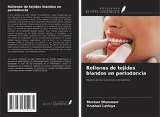 Rellenos de tejidos blandos en periodoncia的封面