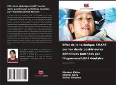 Обложка Effet de la technique SMART sur les dents postérieures définitives touchées par l'hypersensibilité dentaire