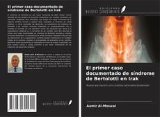 Portada del libro de El primer caso documentado de síndrome de Bertolotti en Irak