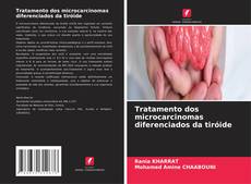 Buchcover von Tratamento dos microcarcinomas diferenciados da tiróide