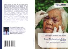 Borítókép a  Ocular Manifestations in Orbital Fractures - hoz