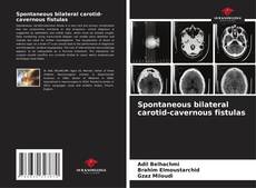 Borítókép a  Spontaneous bilateral carotid-cavernous fistulas - hoz