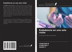 Endodoncia en una sola visita的封面