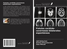 Обложка Fístulas carótido-cavernosas bilaterales espontáneas