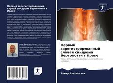 Buchcover von Первый зарегистрированный случай синдрома Бертолотти в Ираке