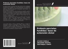 Prótesis parciales fundidas: base de extensión distal的封面