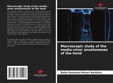Bookcover of Macroscopic study of the medio-ulnar anastomoses of the hand