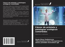Capa do livro de Cáncer de próstata y patologías urológicas comórbidas 