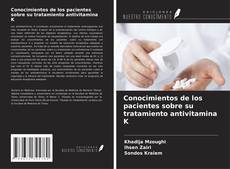 Couverture de Conocimientos de los pacientes sobre su tratamiento antivitamina K