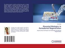 Borítókép a  Placental Biologics in Periodontal Regeneration - hoz