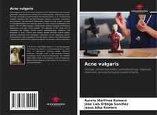 Couverture de Acne vulgaris