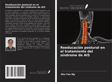 Reeducación postural en el tratamiento del síndrome de AIS的封面