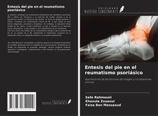 Bookcover of Entesis del pie en el reumatismo psoriásico