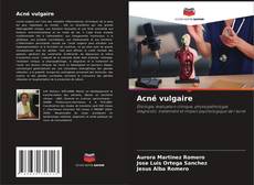 Acné vulgaire kitap kapağı