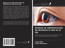 Portada del libro de Sistema de administración de fármacos in situ en el ojo