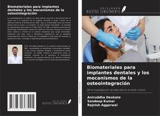 Buchcover von Biomateriales para implantes dentales y los mecanismos de la osteointegración