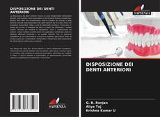 Bookcover of DISPOSIZIONE DEI DENTI ANTERIORI