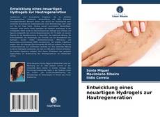 Portada del libro de Entwicklung eines neuartigen Hydrogels zur Hautregeneration