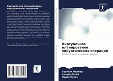 Buchcover von Виртуальное планирование хирургических операций