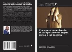 Una nueva cara: Aceptar el vitíligo como un regalo divino a los sesenta的封面
