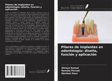 Borítókép a  Pilares de implantes en odontología: diseño, función y aplicación - hoz