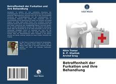 Betroffenheit der Furkation und ihre Behandlung kitap kapağı