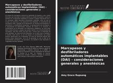 Обложка Marcapasos y desfibriladores automáticos implantables (DAI) - consideraciones generales y anestésicas
