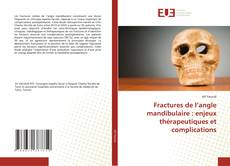 Copertina di Fractures de l’angle mandibulaire : enjeux thérapeutiques et complications
