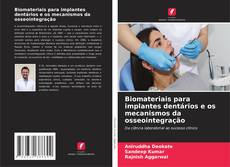 Buchcover von Biomateriais para implantes dentários e os mecanismos da osseointegração