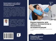 Copertina di Биоматериалы для зубных имплантатов и механизмы остеоинтеграции
