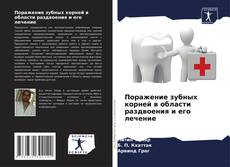 Поражение зубных корней в области раздвоения и его лечение的封面