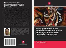 Copertina di Neuroproteómica dos Biomarcadores do Abuso de Drogas e da Lesão Cerebral Traumática