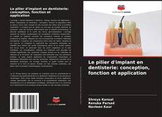 Bookcover of Le pilier d'implant en dentisterie: conception, fonction et application