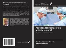 Обложка Pseudoaneurismas de la arteria femoral